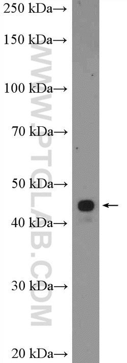 ZIC3 Rabbit anti-Human, Mouse, Polyclonal, Proteintech 150 &mu;L; Unconjugated:Antibodies,
