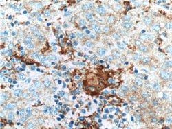PFKFB1 Rabbit anti-Human, Polyclonal, Proteintech 150 &mu;L; Unconjugated:Antibodies,