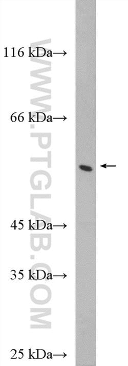 PFKFB1 Rabbit anti-Human, Polyclonal, Proteintech 150 &mu;L; Unconjugated:Antibodies,