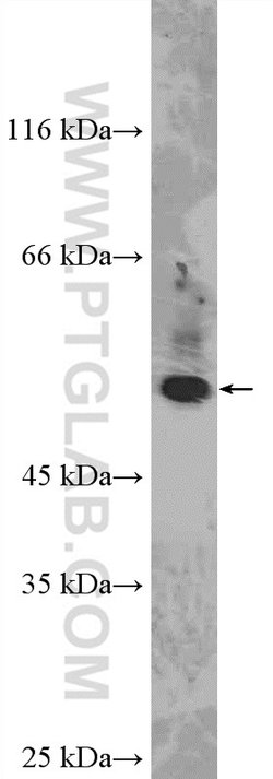 PFKFB1 Rabbit anti-Human, Polyclonal, Proteintech 150 &mu;L; Unconjugated:Antibodies,