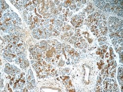 SERPINB10 Rabbit anti-Human, Mouse, Rat, Polyclonal, Proteintech 150 &mu;L;