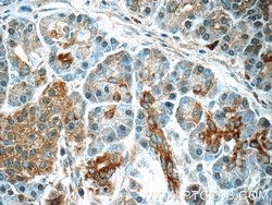 SERPINB10 Rabbit anti-Human, Mouse, Rat, Polyclonal, Proteintech 150 &mu;L;