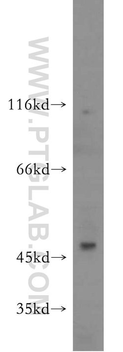 SERPINB10 Rabbit anti-Human, Mouse, Rat, Polyclonal, Proteintech 150 &mu;L;