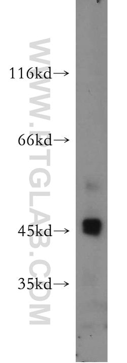 SERPINB10 Rabbit anti-Human, Mouse, Rat, Polyclonal, Proteintech 150 &mu;L;