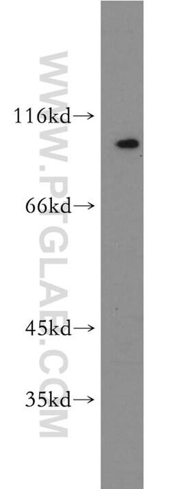 SERPINB10 Rabbit anti-Human, Mouse, Rat, Polyclonal, Proteintech 150 &mu;L;