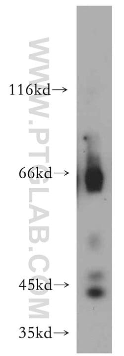 INPP5A Rabbit anti-Human, Mouse, Rat, Polyclonal, Proteintech:Antibodies:Primary