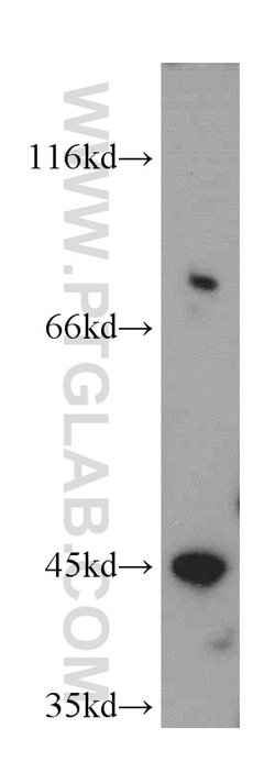 INPP5A Rabbit anti-Human, Mouse, Rat, Polyclonal, Proteintech:Antibodies:Primary