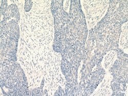 KRT2 Rabbit anti-Human, Polyclonal, Proteintech 150 &mu;L; Unconjugated:Antibodies,