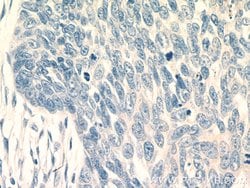 KRT2 Rabbit anti-Human, Polyclonal, Proteintech 150 &mu;L; Unconjugated:Antibodies,