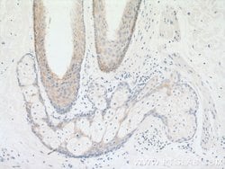 KRT2 Rabbit anti-Human, Polyclonal, Proteintech 150 &mu;L; Unconjugated:Antibodies,