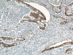 Integrin beta-4 Rabbit anti-Human, Mouse, Rat, Polyclonal, Proteintech