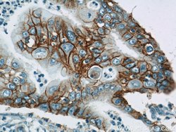 Integrin beta-4 Rabbit anti-Human, Mouse, Rat, Polyclonal, Proteintech