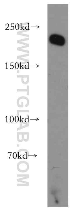 Integrin beta-4 Rabbit anti-Human, Mouse, Rat, Polyclonal, Proteintech