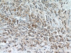 Integrin beta-4 Rabbit anti-Human, Mouse, Rat, Polyclonal, Proteintech