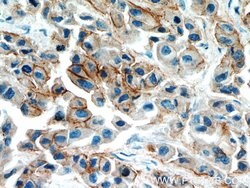 Integrin beta-4 Rabbit anti-Human, Mouse, Rat, Polyclonal, Proteintech
