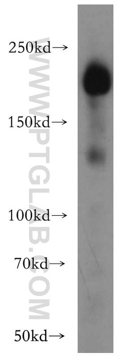 Integrin beta-4 Rabbit anti-Human, Mouse, Rat, Polyclonal, Proteintech