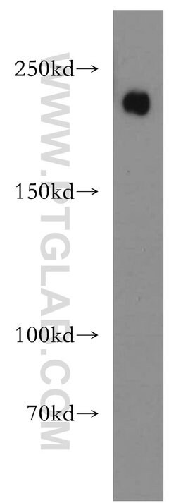 Integrin beta-4 Rabbit anti-Human, Mouse, Rat, Polyclonal, Proteintech