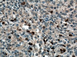 CARD11 Rabbit anti-Human, Mouse, Rat, Polyclonal, Proteintech:Antibodies:Primary