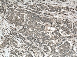 CARD11 Rabbit anti-Human, Mouse, Rat, Polyclonal, Proteintech:Antibodies:Primary
