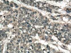CARD11 Rabbit anti-Human, Mouse, Rat, Polyclonal, Proteintech:Antibodies:Primary