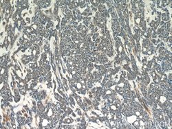 APC1 Rabbit anti-Human, Mouse, Rat, Polyclonal, Proteintech:Antibodies:Primary