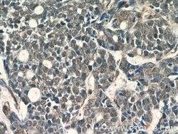 APC1 Rabbit anti-Human, Mouse, Rat, Polyclonal, Proteintech:Antibodies:Primary
