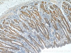 APC1 Rabbit anti-Human, Mouse, Rat, Polyclonal, Proteintech:Antibodies:Primary