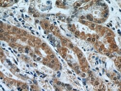 APC1 Rabbit anti-Human, Mouse, Rat, Polyclonal, Proteintech:Antibodies:Primary