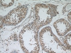 APC1 Rabbit anti-Human, Mouse, Rat, Polyclonal, Proteintech:Antibodies:Primary