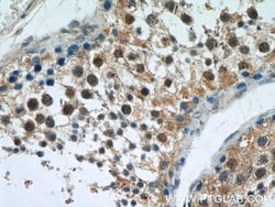 APC1 Rabbit anti-Human, Mouse, Rat, Polyclonal, Proteintech:Antibodies:Primary