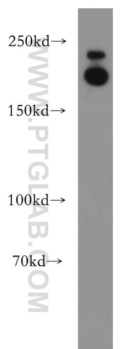 APC1 Rabbit anti-Human, Mouse, Rat, Polyclonal, Proteintech:Antibodies:Primary