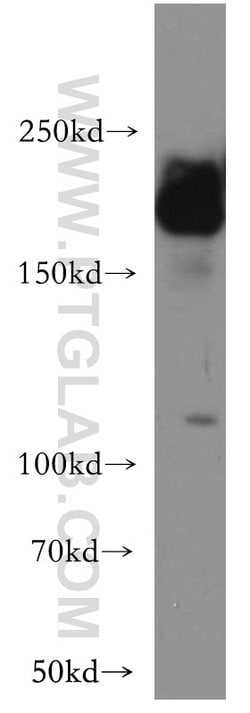 APC1 Rabbit anti-Human, Mouse, Rat, Polyclonal, Proteintech:Antibodies:Primary