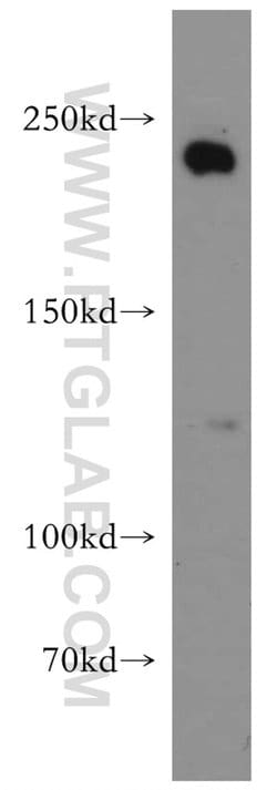 APC1 Rabbit anti-Human, Mouse, Rat, Polyclonal, Proteintech:Antibodies:Primary