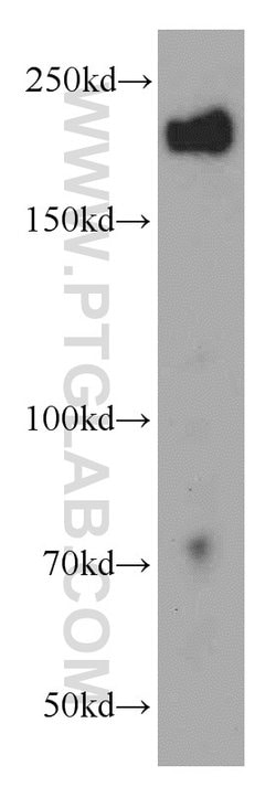 APC1 Rabbit anti-Human, Mouse, Rat, Polyclonal, Proteintech:Antibodies:Primary