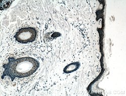 ZNF750 Rabbit anti-Human, Mouse, Polyclonal, Proteintech:Antibodies:Primary