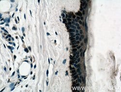 ZNF750 Rabbit anti-Human, Mouse, Polyclonal, Proteintech:Antibodies:Primary