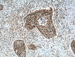 ZNF750 Rabbit anti-Human, Mouse, Polyclonal, Proteintech:Antibodies:Primary