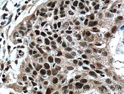 ZNF750 Rabbit anti-Human, Mouse, Polyclonal, Proteintech:Antibodies:Primary