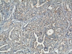 RASSF7 Rabbit anti-Human, Polyclonal, Proteintech:Antibodies:Primary Antibodies