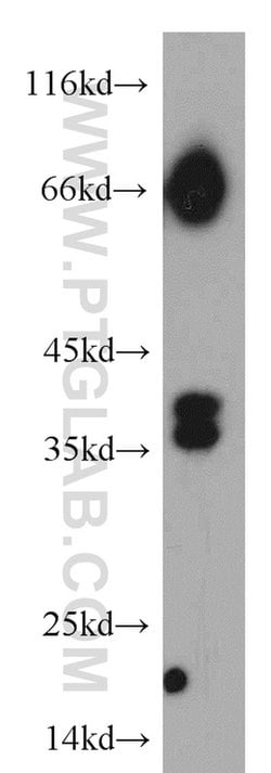 RASSF7 Rabbit anti-Human, Polyclonal, Proteintech:Antibodies:Primary Antibodies
