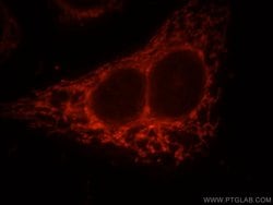 FAM117B Rabbit anti-Human, Polyclonal, Proteintech:Antibodies:Primary Antibodies