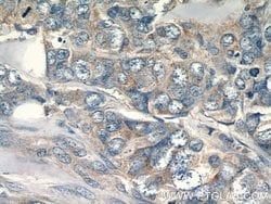 FAM117B Rabbit anti-Human, Polyclonal, Proteintech:Antibodies:Primary Antibodies