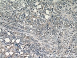 FAM117B Rabbit anti-Human, Polyclonal, Proteintech:Antibodies:Primary Antibodies