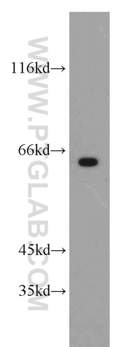 FAM117B Rabbit anti-Human, Polyclonal, Proteintech:Antibodies:Primary Antibodies