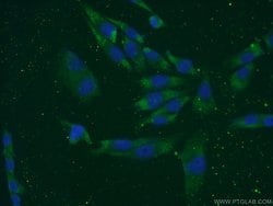 LCE1B Rabbit anti-Human, Mouse, Rat, Polyclonal, Proteintech 150 &mu;L;