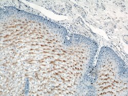 LCE1B Rabbit anti-Human, Mouse, Rat, Polyclonal, Proteintech 150 &mu;L;