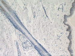 LCE1B Rabbit anti-Human, Mouse, Rat, Polyclonal, Proteintech 150 &mu;L;