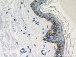 LCE1B Rabbit anti-Human, Mouse, Rat, Polyclonal, Proteintech 150 &mu;L;