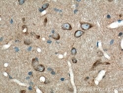 L-VOCC Rabbit anti-Human, Mouse, Rat, Polyclonal, Proteintech 150 &mu;L;