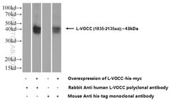 L-VOCC Rabbit anti-Human, Mouse, Rat, Polyclonal, Proteintech 150 &mu;L;